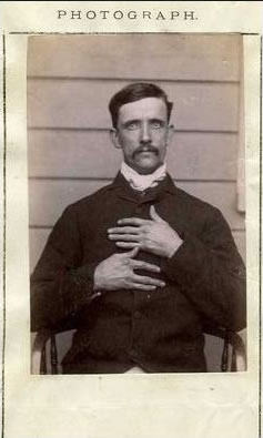 Distinctive marks mug shot - Charles Fowler