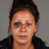 injuries caused by assault