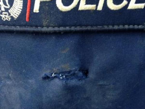 Puncture wounds caused by pitbull dog on Constable Klinkenberg's vest