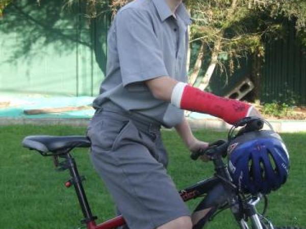 Jonathan McAdam with his new cast and cycle helmet that saved him from serious injury