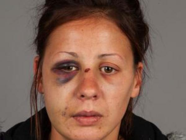 injuries caused by assault